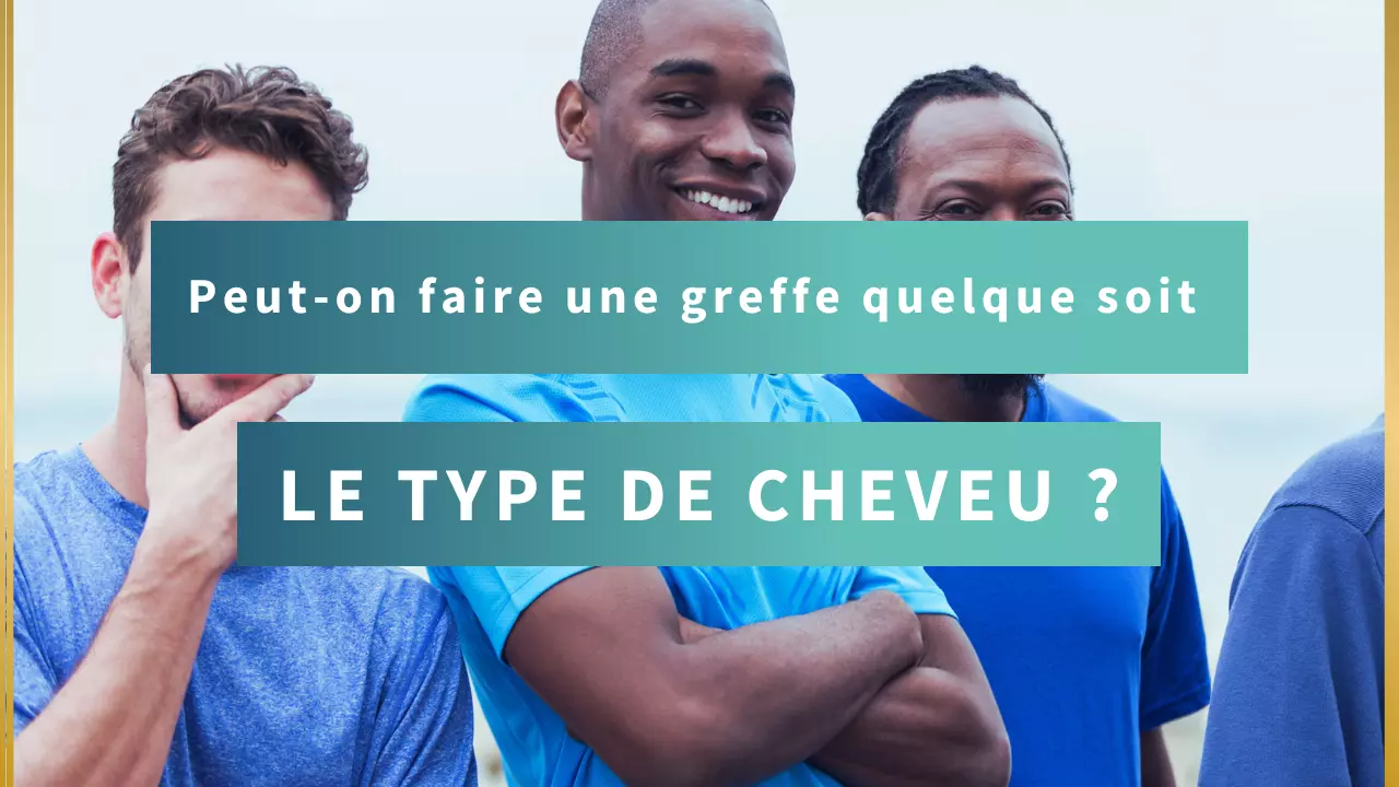 Quel Type de cheveux pour la greffe capillaire