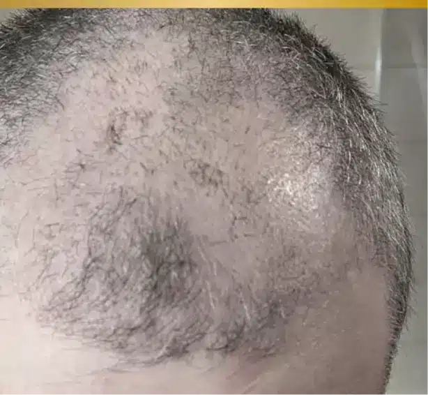 repousse cheveux