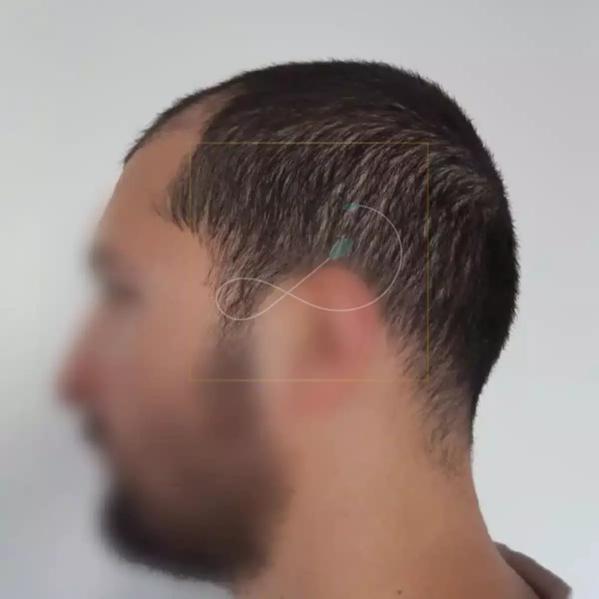 Avant
