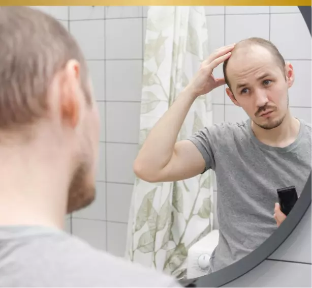 Perte cheveux et estime de soi
